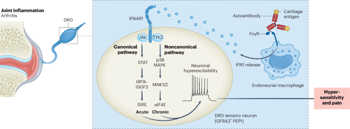 Neuroimmune interferon signals sustain arthritis pain