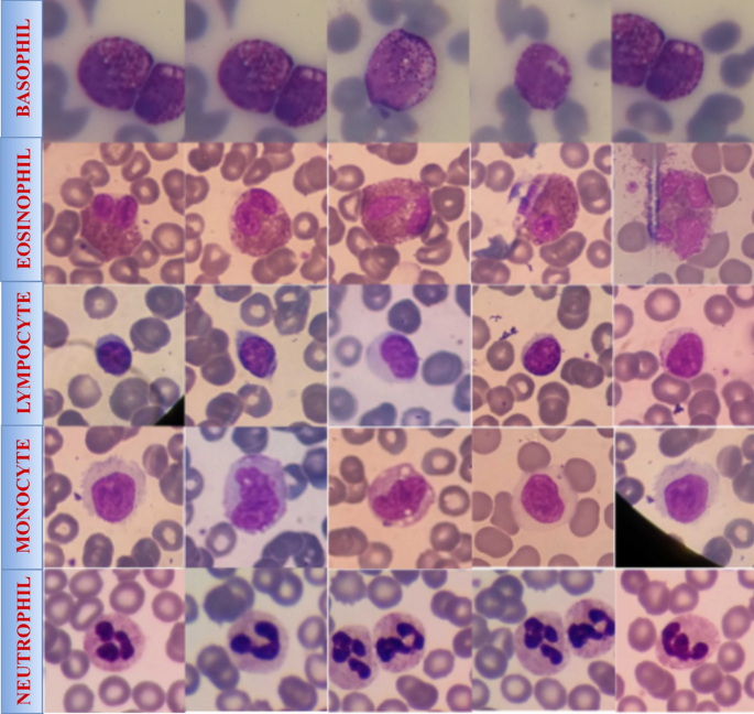 White blood cell classification using custom deep neural network and visualizing features of the images using heatmaps