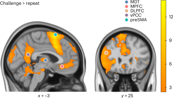Cognitive restructuring and thalamocortical circuit alterations in post-traumatic stress disorder
