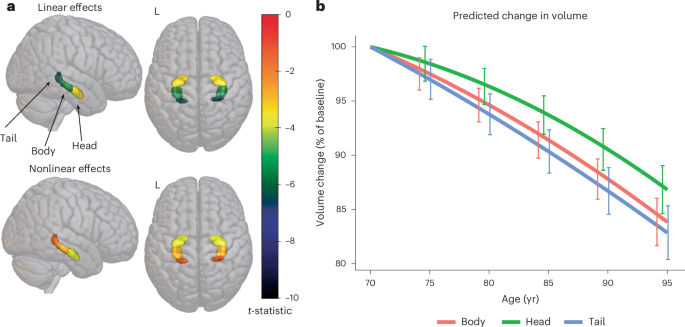 Neighborhood street connectivity and hippocampus volume in older adults