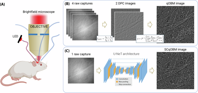 Single capture quantitative oblique back-illumination microscopy