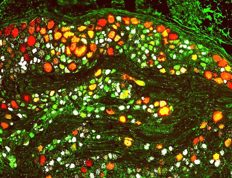 Engineered zinc finger repressors induce a prolonged and selective repression of SCN9A in nociceptors of nonhuman primates | Science Translational Medicine