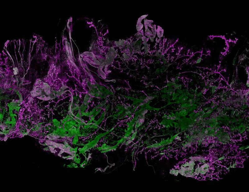 Patient-derived xenograft models of primary breast cancer for preclinical evaluation of neoadjuvant therapies | Science Translational Medicine