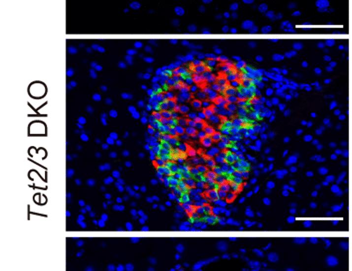 Epigenetically regulated pancreatic GABA-somatostatin signaling underlies gestational diabetes–induced glucose intolerance in offspring | Science Translational Medicine