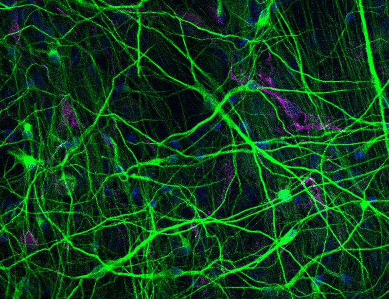 Modulating alternative splicing of MECP2 is a potential therapeutic strategy for Rett syndrome | Science Translational Medicine