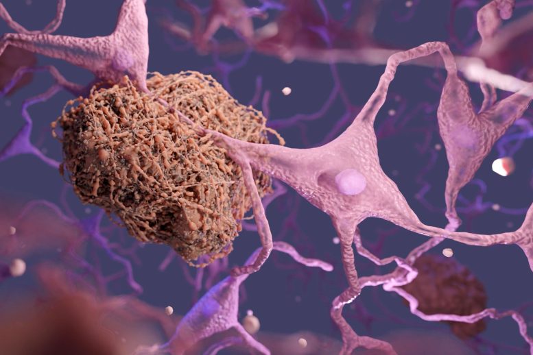 Scientists Discover Way To Reverse Chemical Process Linked With Alzheimer’s Disease