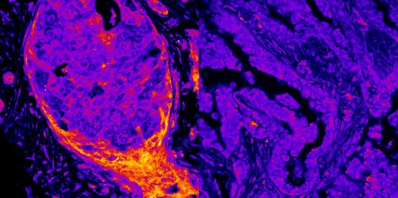 Scientists Discover Hundreds of Energy Enzymes Sitting Directly on Human DNA