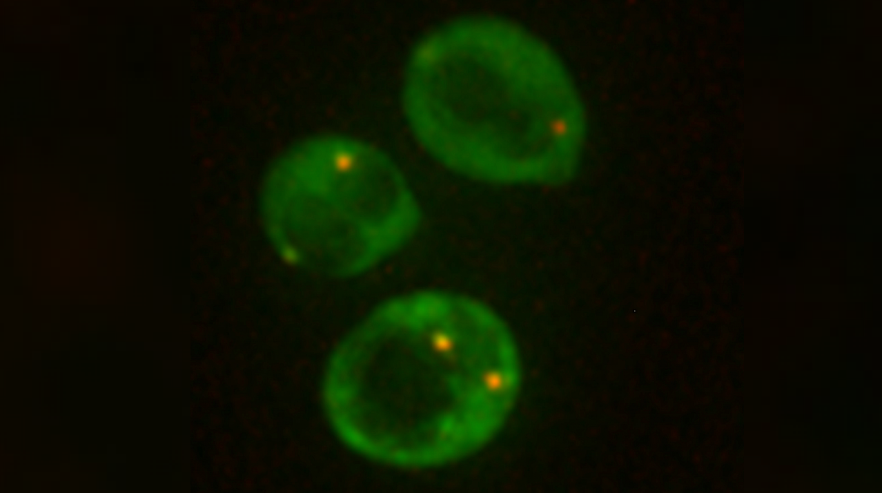 Can Yeast Survive On Mars?