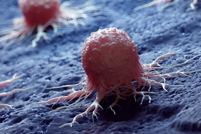 Scientists Uncover Hidden Cancer Risk in Common Bowel Growths