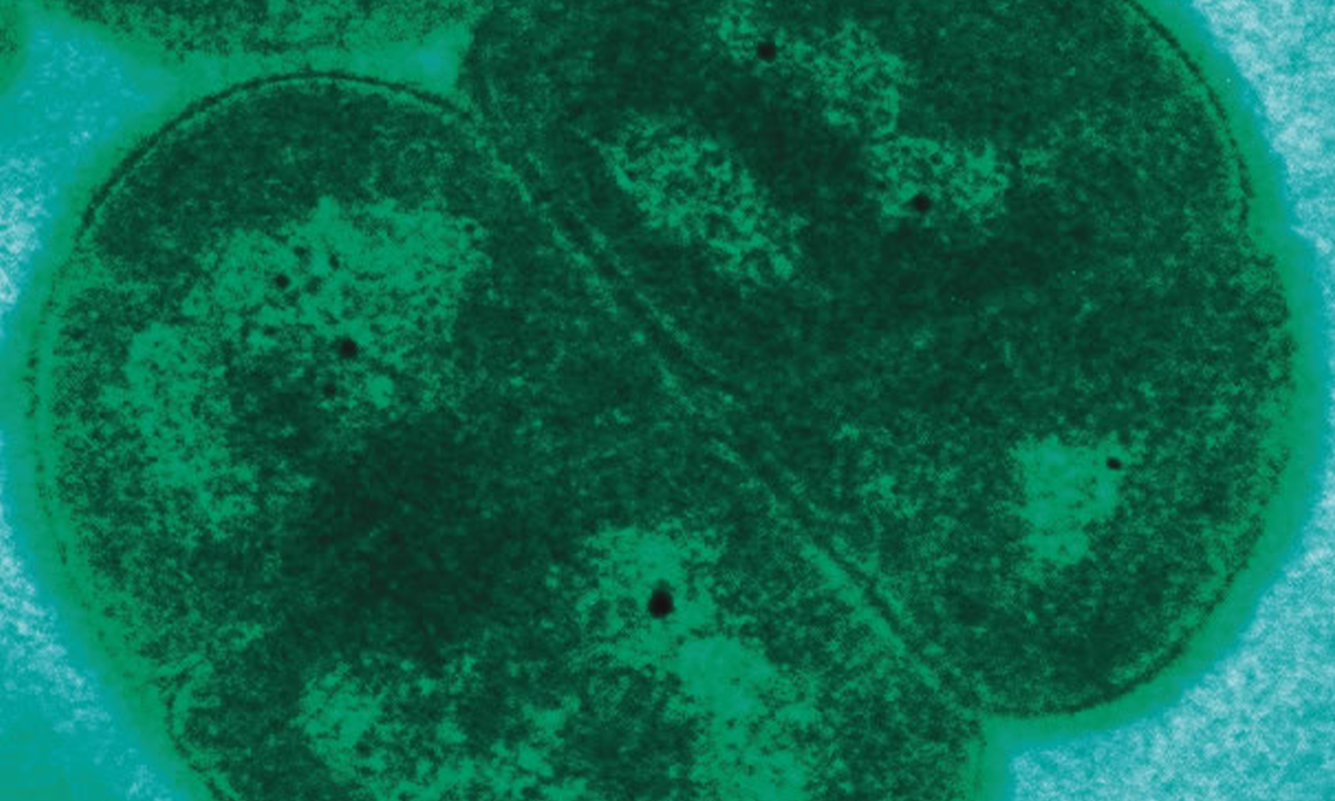 Watch How Planet-Hopping Microbes Can Survive Asteroid Strikes