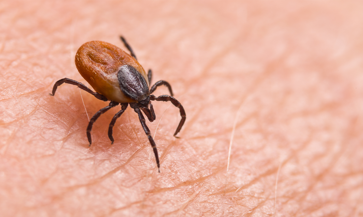 Why We Don’t Have a Lyme Disease Vaccine