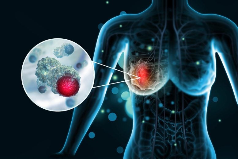 Scientists Discover Molecular “Switch” That Could Stop Breast Cancer From Spreading