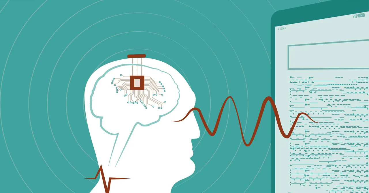 China Approves the First Brain Chips for Sale—and Has a Plan to Dominate the Industry