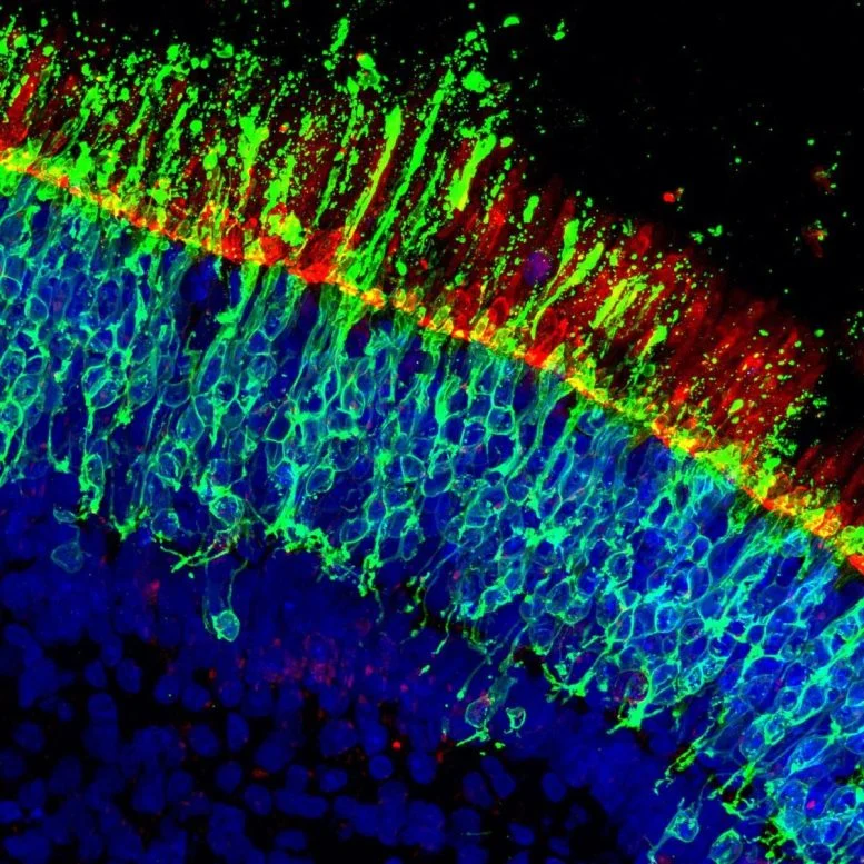 Scientists Discover How to Stop Vision Loss Before It Starts