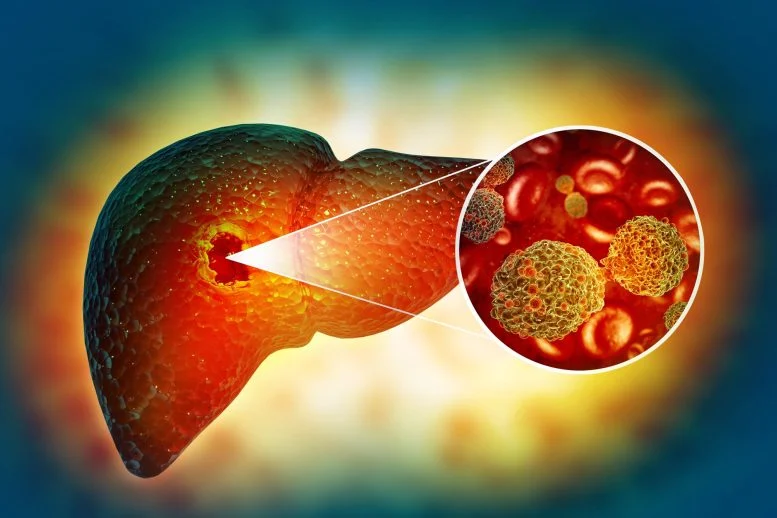 A Promising Fatty Liver Treatment May Actually Trigger Cancer