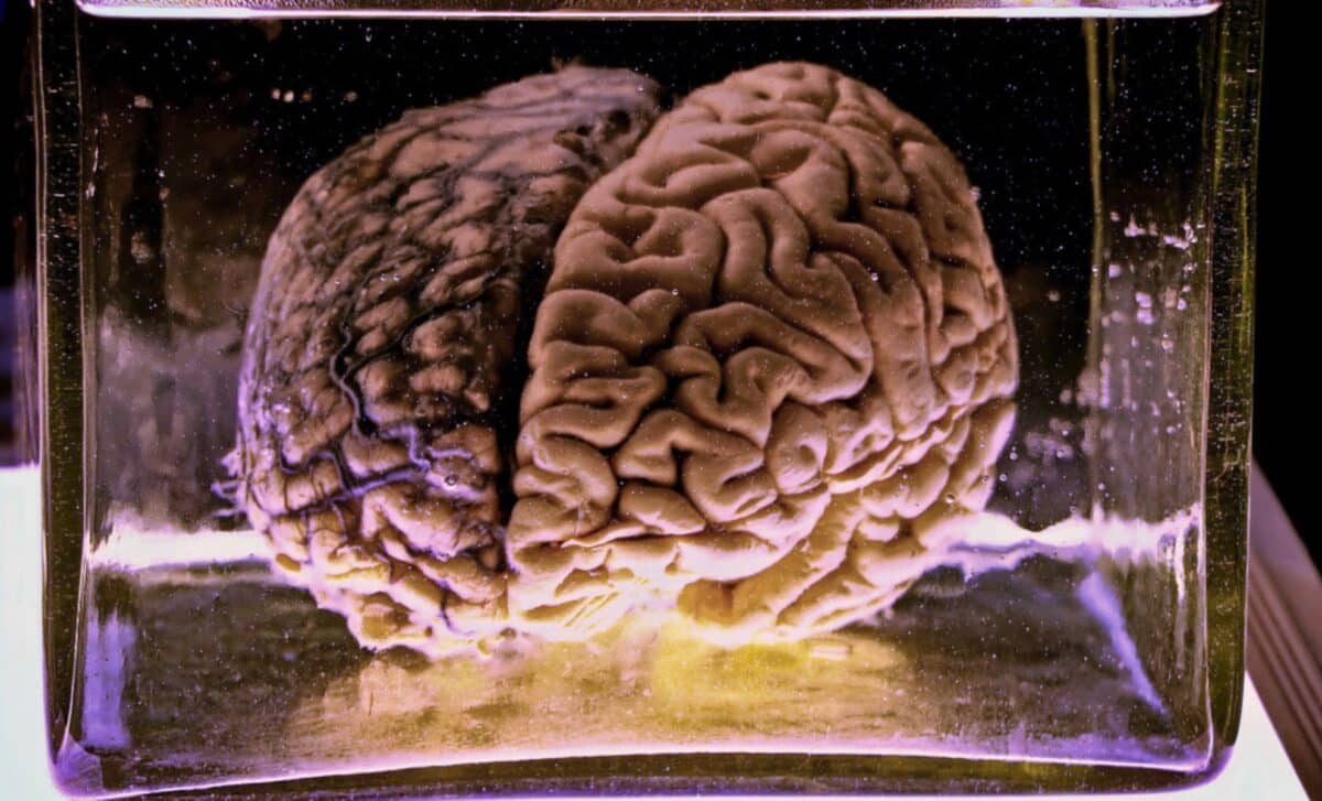 Scientists Revive Brain Activity for the First Time After Seven Days in a Frozen Suspended State