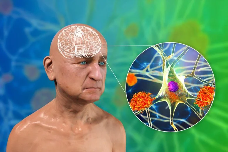 New Study Challenges Decades of Alzheimer’s Understanding With Microtubule Discovery