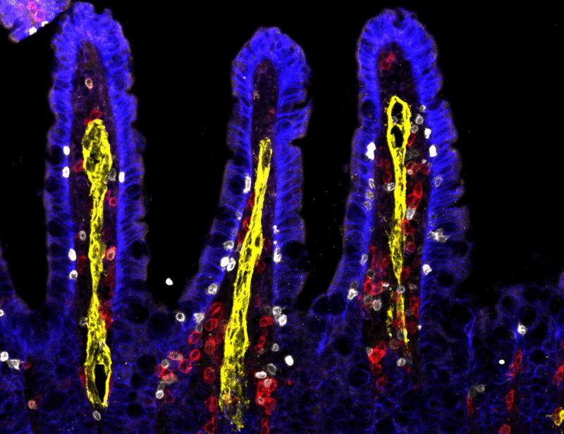 Inflammatory ILC2s migrate to distal tissues during infection using stage-specific S1P receptors | Science Immunology