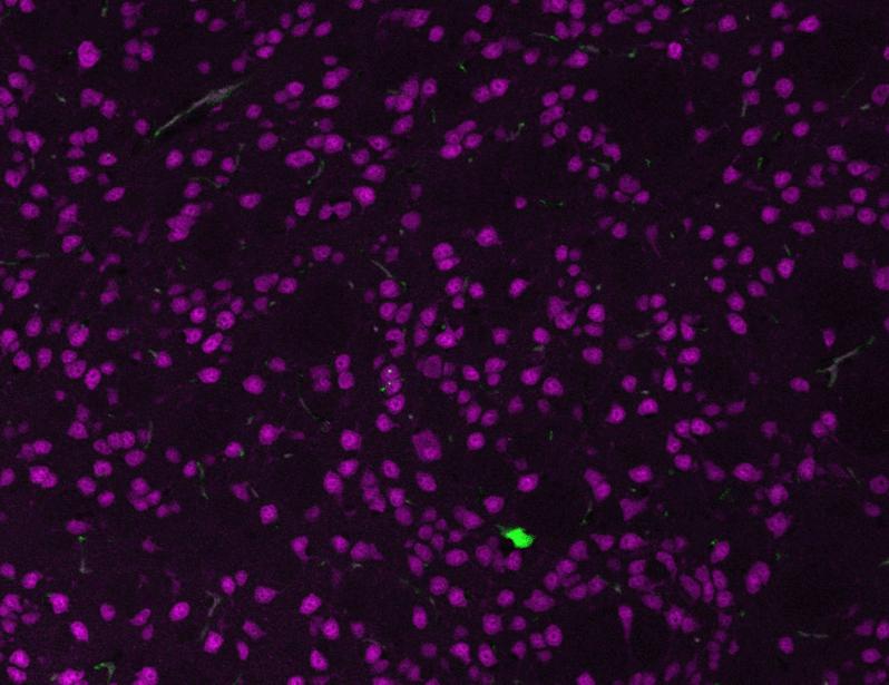 Selective targeting of mutant huntingtin intron 1 improves rescue provided by antisense oligonucleotides in Huntington’s disease mice | Science Translational Medicine