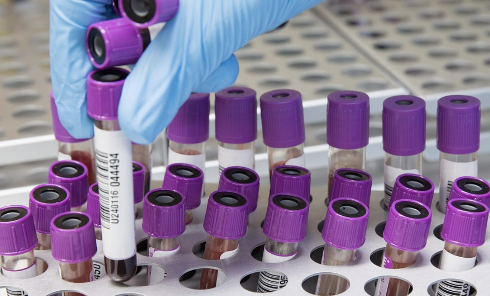 A Simple Vitamin B3 Treatment Could Relieve a Rare Disease