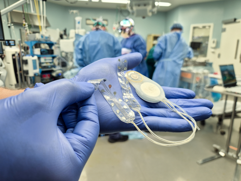 German technology company CorTec implants second human with its brain-computer interface