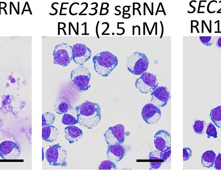 LSD1 inhibition ameliorates congenital dyserythropoietic anemia type II | Science Translational Medicine