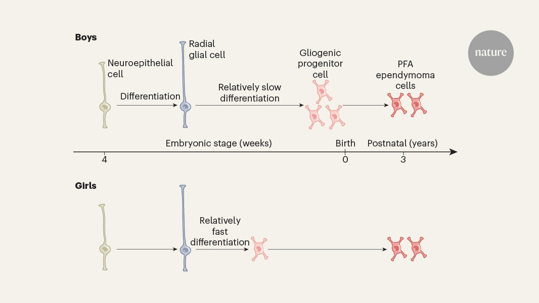 Testosterone promotes growth of a type of brain tumour in young boys