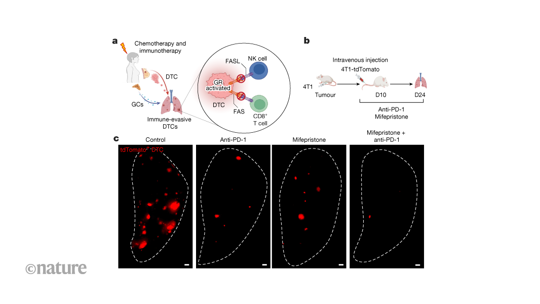 Stress-hormone signalling protects spreading cancer cells from immune system
