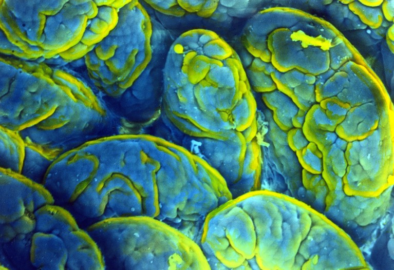 Memory loss is fuelled by gut microbes in ageing mice