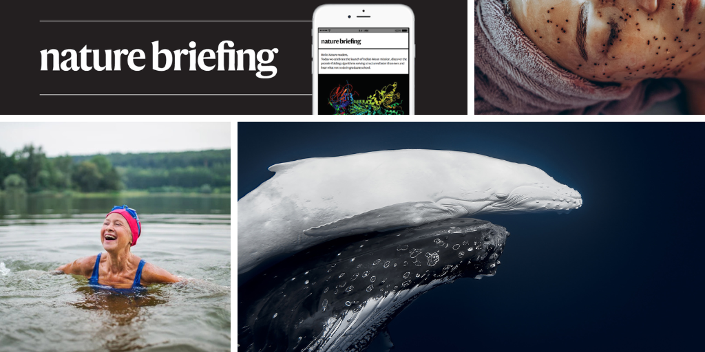 A daily multivitamin slows the signs of biological ageing