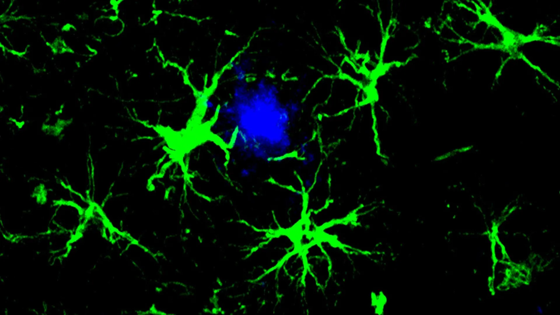 Scientists turn brain cells into Alzheimer’s plaque cleaners