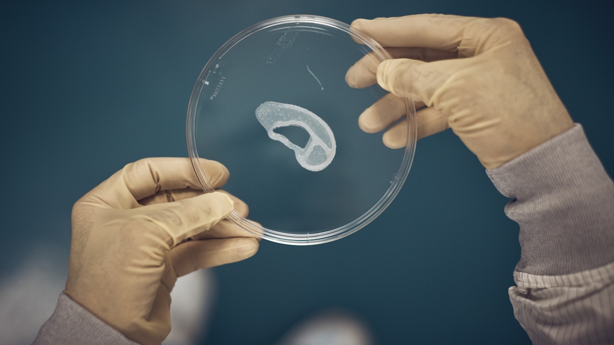 Doctors have long said cartilage can’t regenerate. They’re now rethinking that.