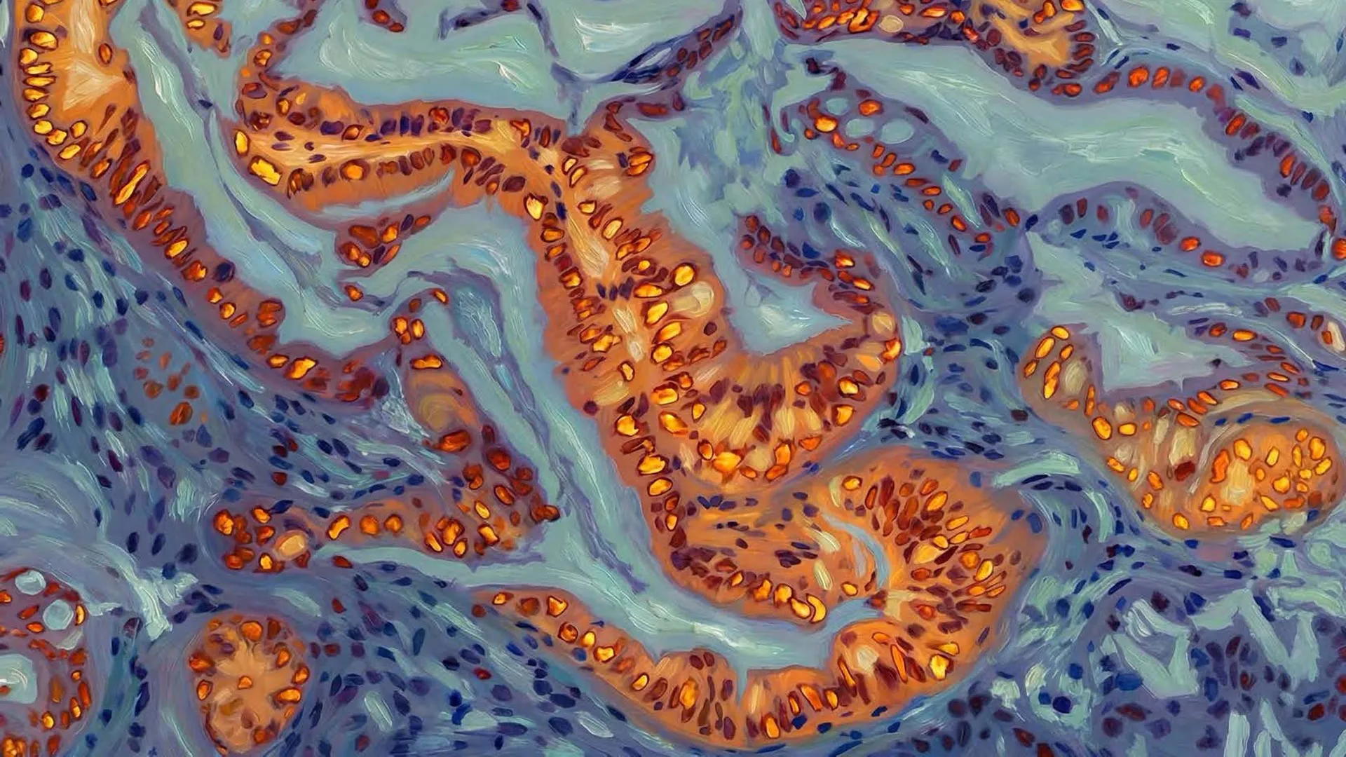 Scientists find the genetic switch that makes pancreatic cancer resist chemotherapy