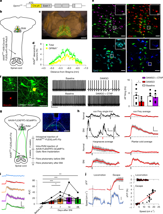Deconstruction of a spino-brain–spinal cord circuit that drives chronic pain
