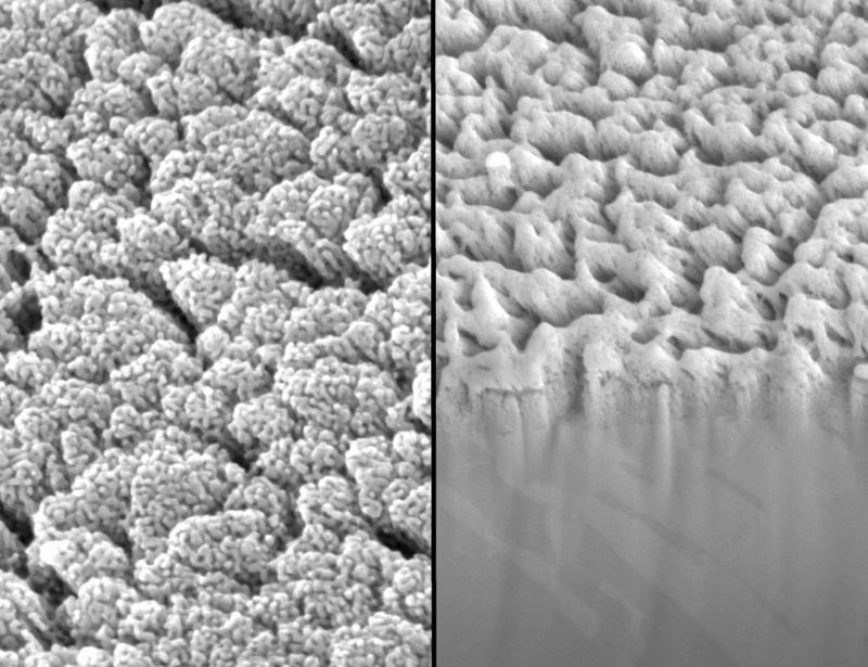Resilient nanostructured bioanalytic microneedle longitudinally monitors preclinical renal and hepatic drug clearance and dysfunction | Science Translational Medicine