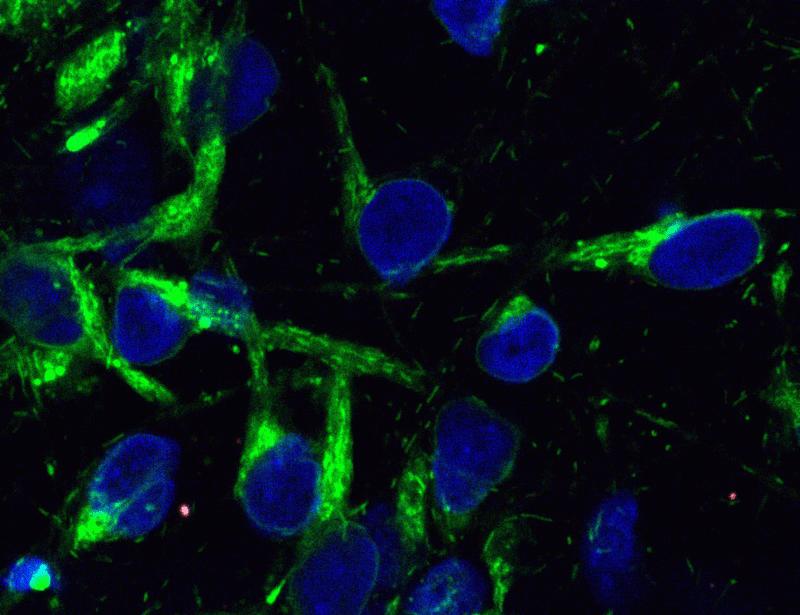 Foldamers rescue synucleinopathy phenotypes in multiple in vitro and in vivo models | Science Translational Medicine