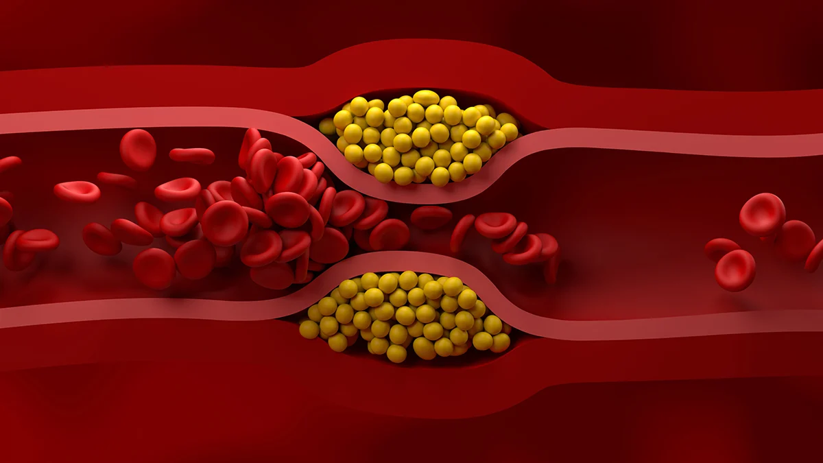 US Cardiologists Have Just Published New Guidelines For Managing Cholesterol : ScienceAlert