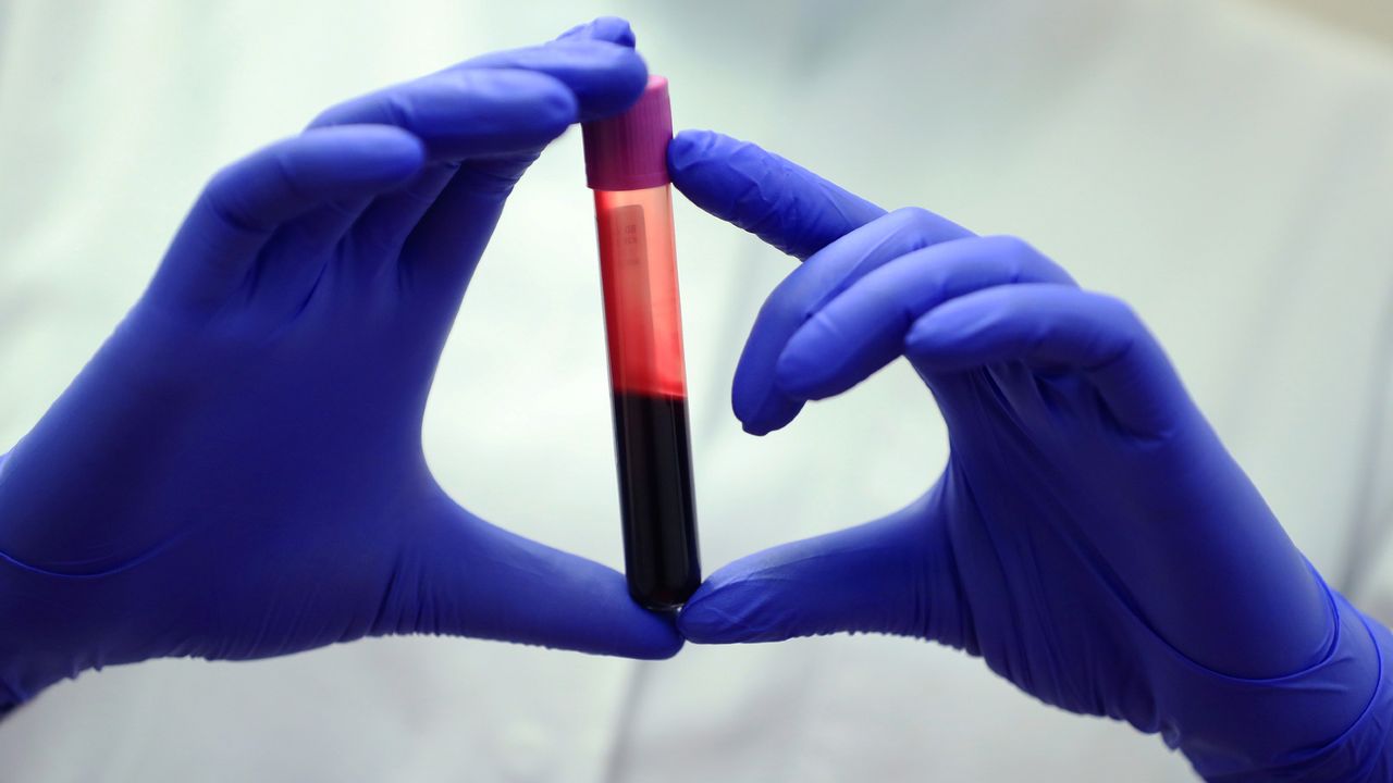 New blood test aims to spot liver scarring when it’s still reversible and before it paves the way to cancer