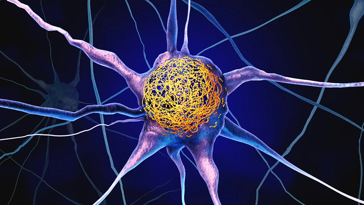 Common Vitamin May Reduce Buildup of Alzheimer’s Proteins, Study Finds : ScienceAlert