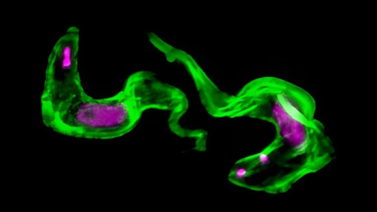 Scientists Solve 40-Year-Old Mystery of Sleeping Sickness Parasite : ScienceAlert