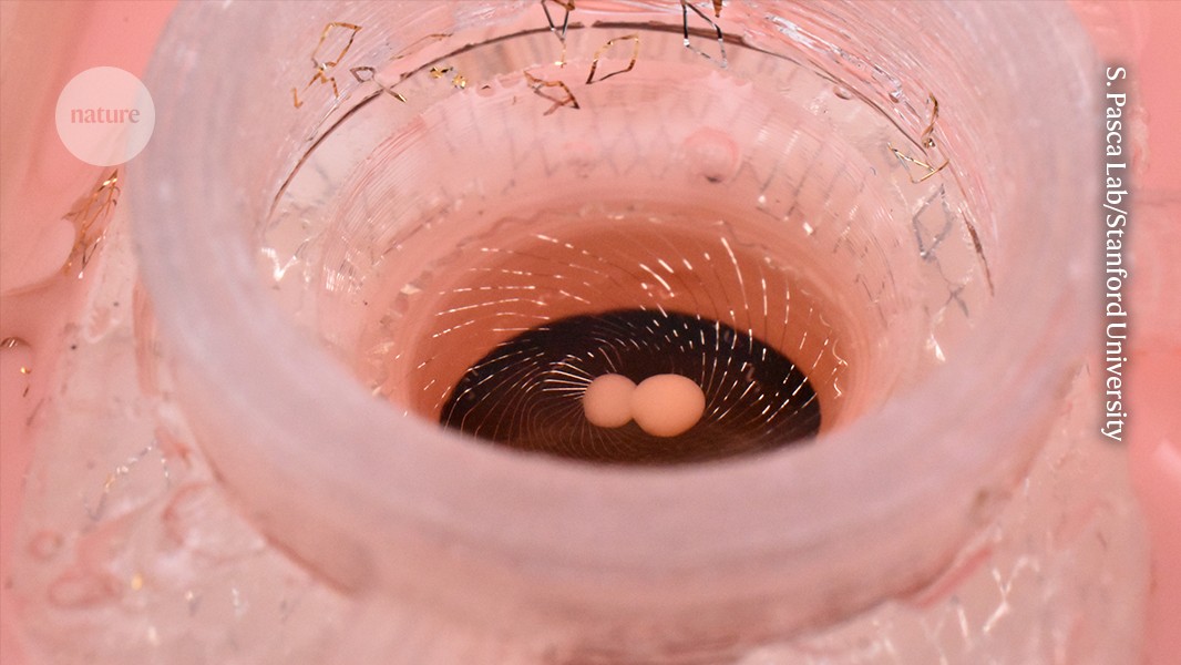 Brain organoids are a transformative technology — but they need regulation