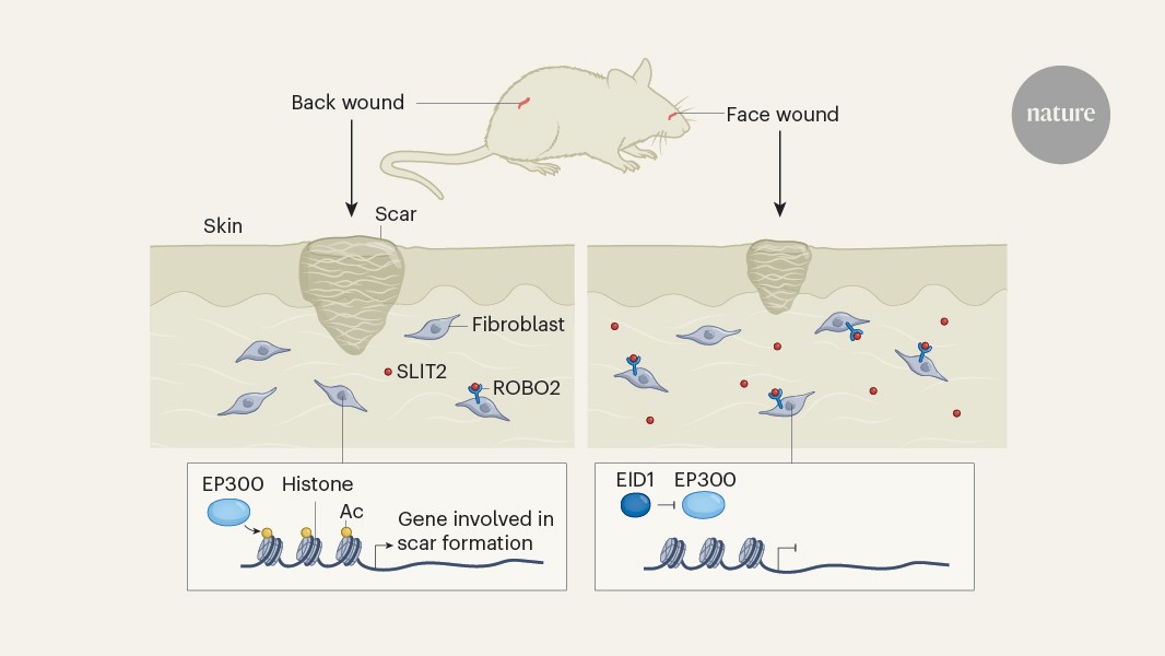 Saving face: why facial scars are smaller than back scars