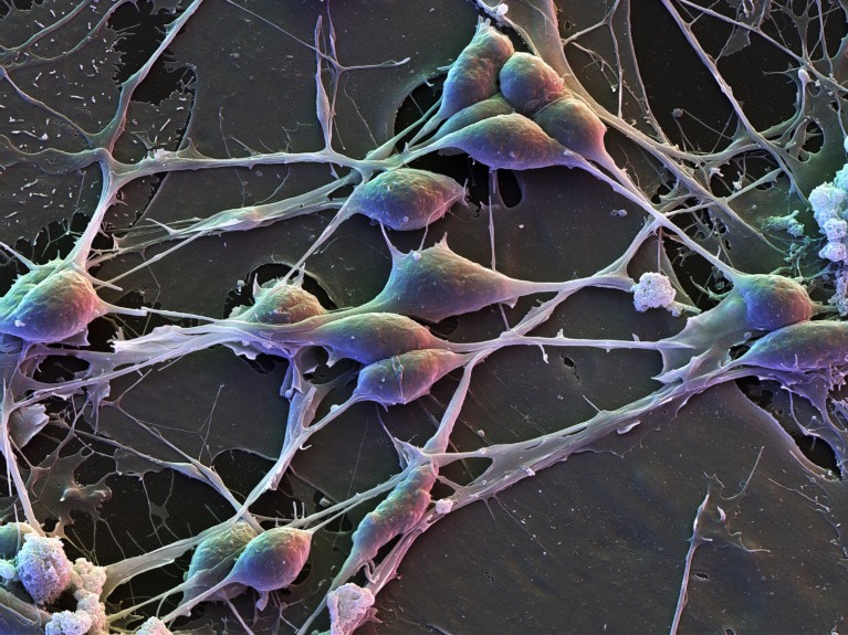 how male and female brain cells differ in gene activity