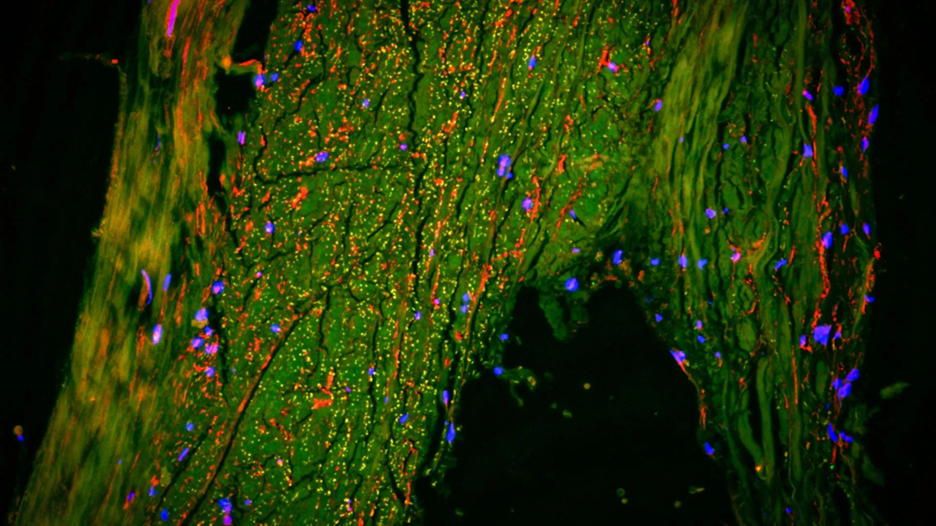 Scientists just found a hidden “drain” inside the human brain