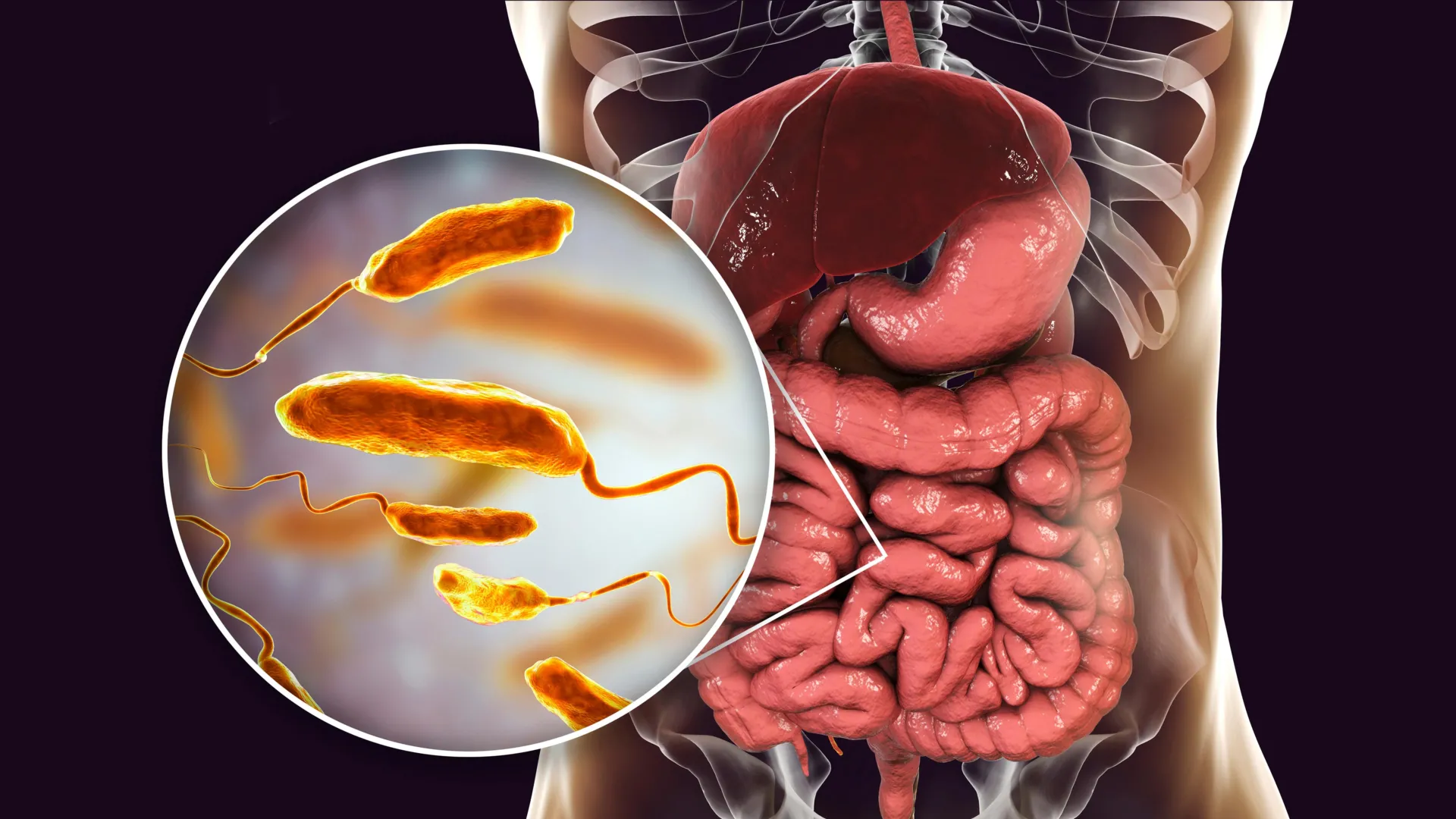 This diet could slash cholera infections by up to 100x