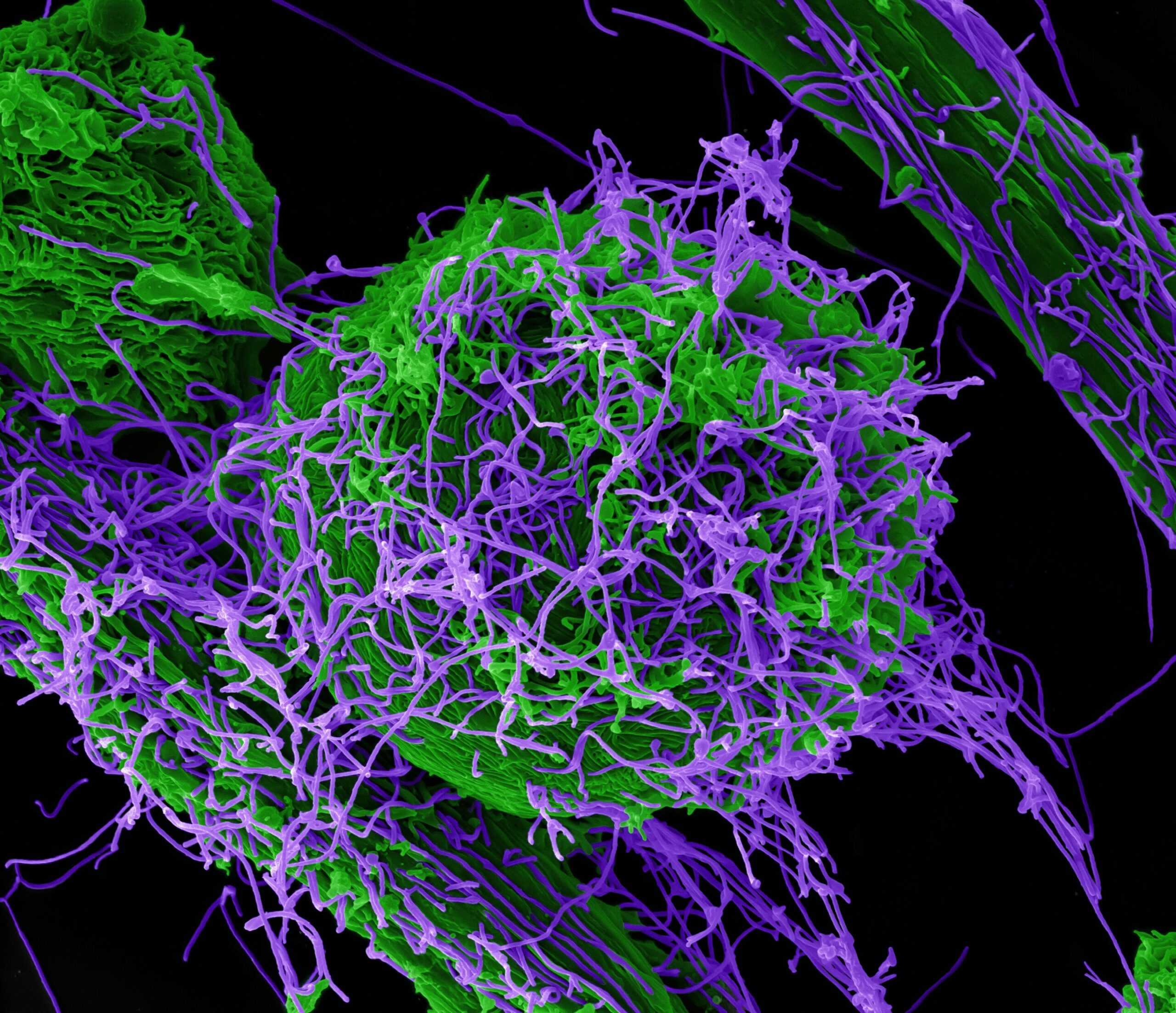Trial of potential Ebola antiviral under way: WHO